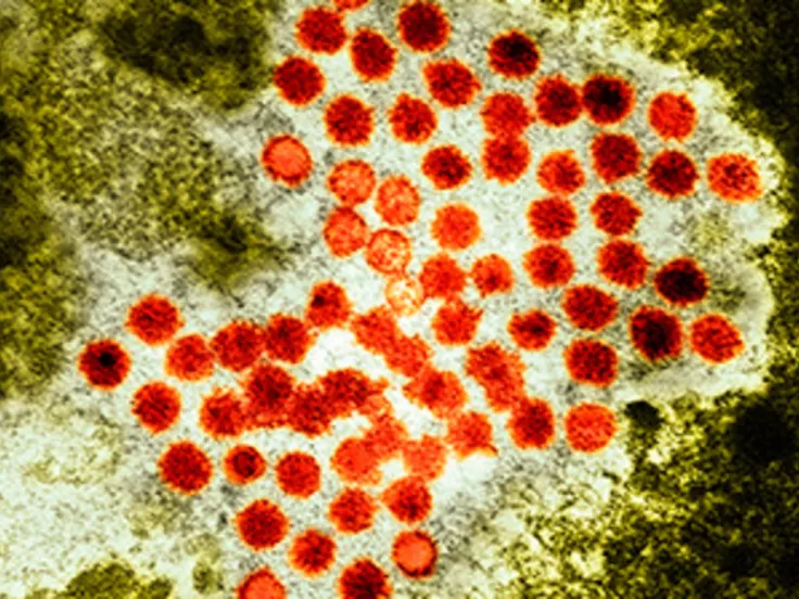 hepatitis