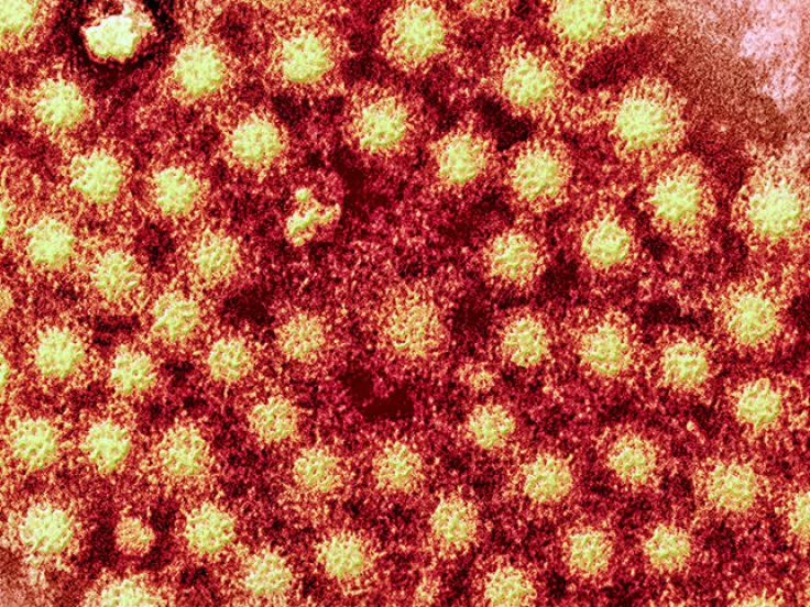 hepatitis