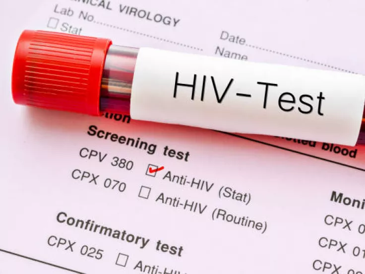 hiv