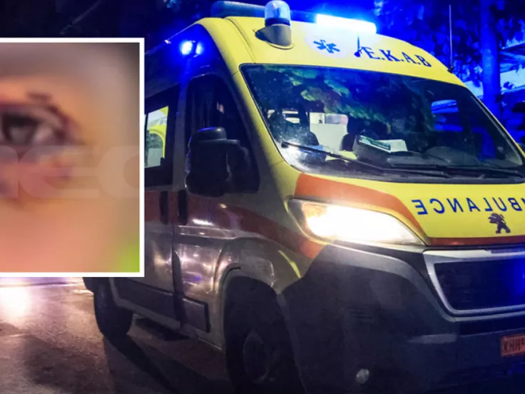 Άγρια επίθεση σε 16χρονο στα Ιωάννινα: Κινδύνευσε να χάσει την όρασή του