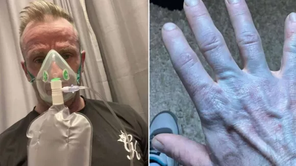 Μπλε από την κορυφή ως τα νύχια: Η απίθανη εμπειρία ενός Βρετανού