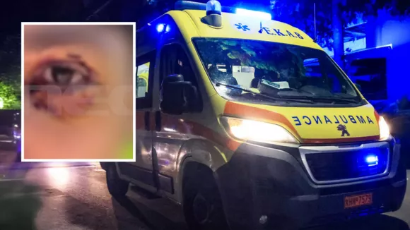 Άγρια επίθεση σε 16χρονο στα Ιωάννινα: Κινδύνευσε να χάσει την όρασή του