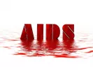 hiv