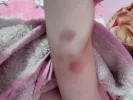 melanies