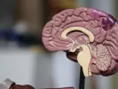 alzheimer