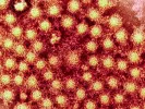 hepatitis