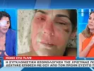 επίθεση με καυστικό υγρό 