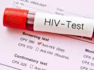 hiv