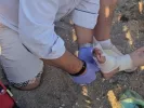 Δάγκωμα θαλάσσιας χελώνας