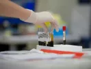 Εξετάσεις αίματος και Υγεία