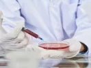 Πλασμαφαίρεση: Τι είναι, πώς πότε επιτρέπεται να γίνει
