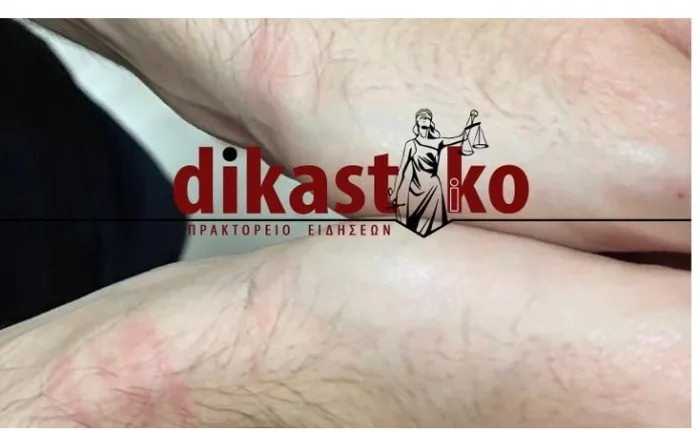 επίθεση ματ σε δικηγόρους